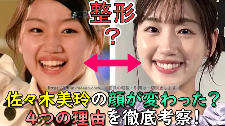 佐々木美玲の顔が変わった？ ４つの理由を徹底考察！
