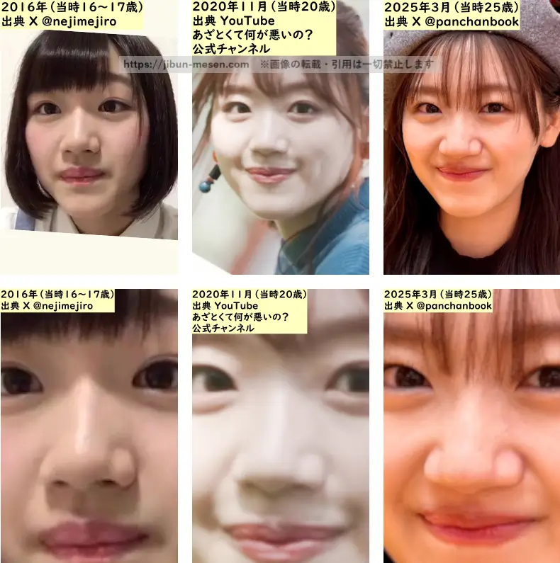 佐々木美玲の鼻の整形検証2016年～2025年の画像