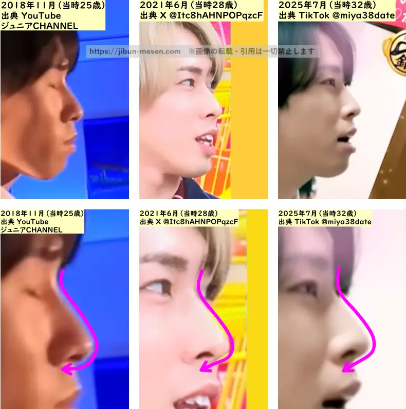 宮舘涼太の鼻の整形検証2018年～2025年（横顔）の画像