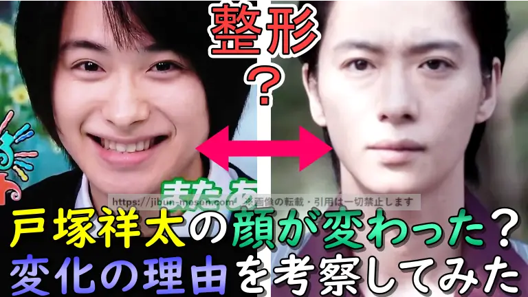 戸塚祥太の顔が変わった？ 変化の理由を考察してみた