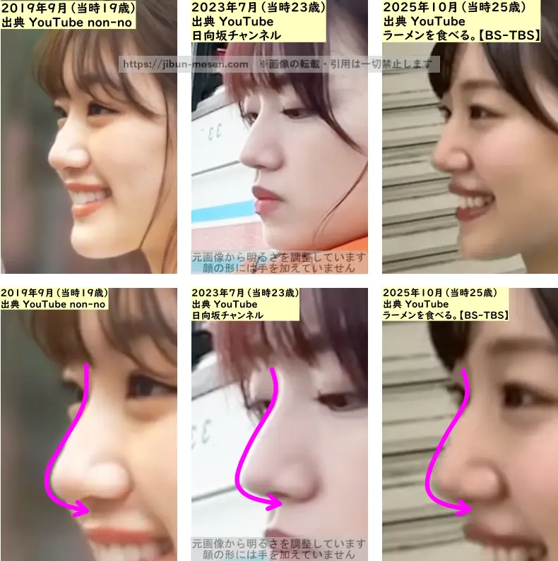 佐々木美玲の鼻の整形検証2019年～2025年（横顔）の画像