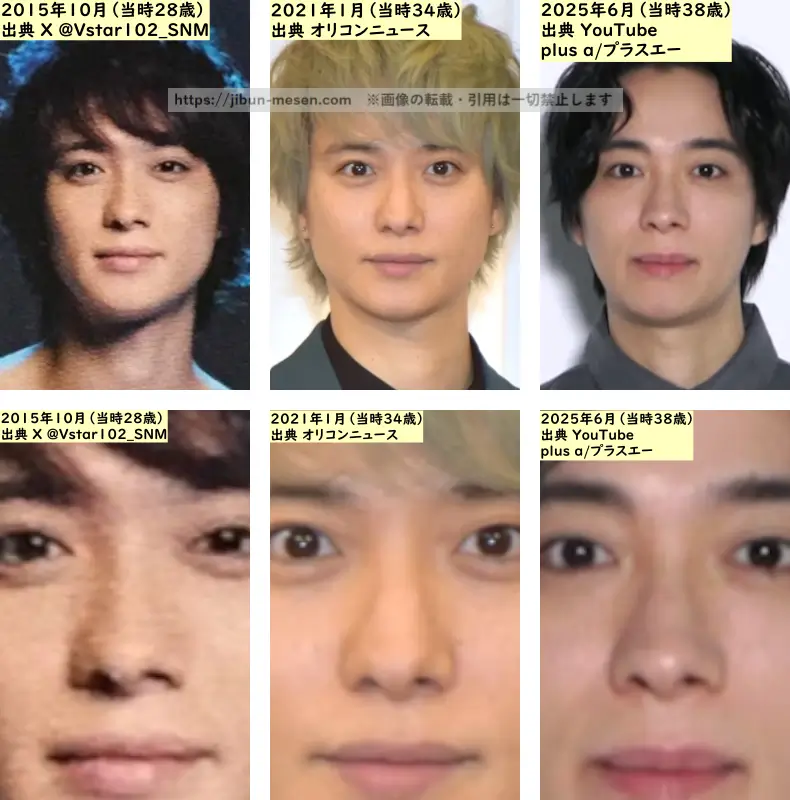 戸塚祥太の鼻の整形検証2015年～2025年の画像