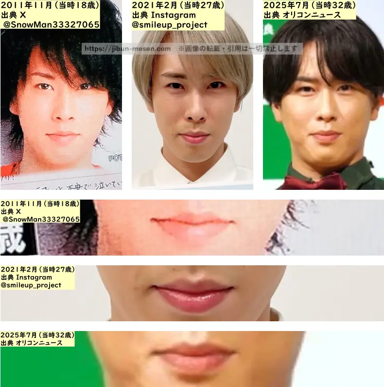 宮舘涼太の唇の整形検証2011年～2025年の画像