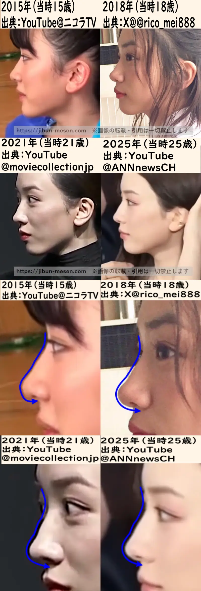 永野芽郁の鼻の整形検証横顔2015年~2025年の画像