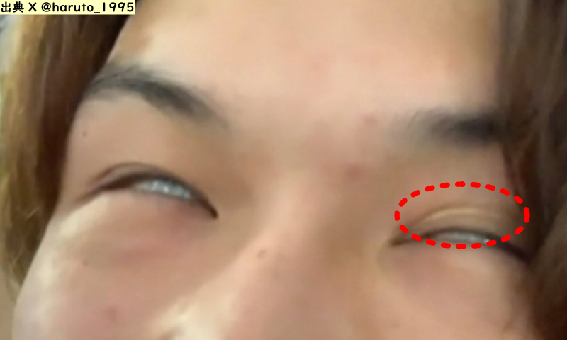 アイプチが見える松村北斗の画像