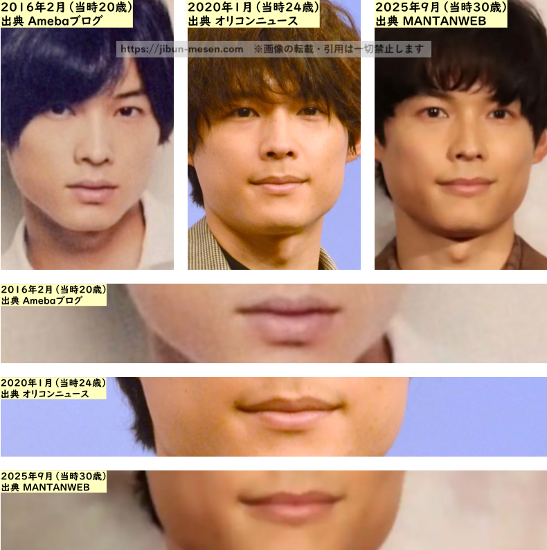 松村北斗の唇の整形検証2016年~2025年の画像