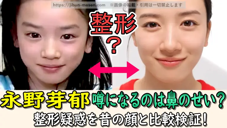 永野芽郁 噂になるのは鼻のせい？ 整形疑惑を昔の顔と比較検証！