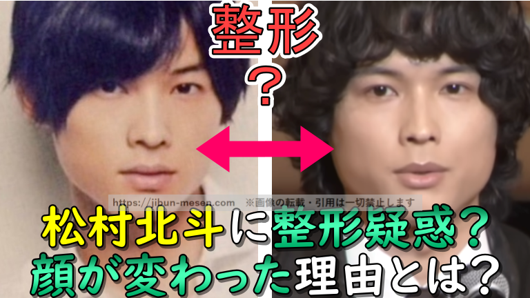 松村北斗の整形の記事の画像