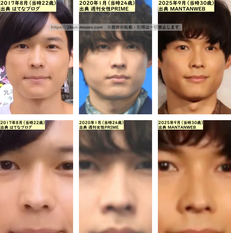 松村北斗の鼻の整形検証2017年~2025年の画像