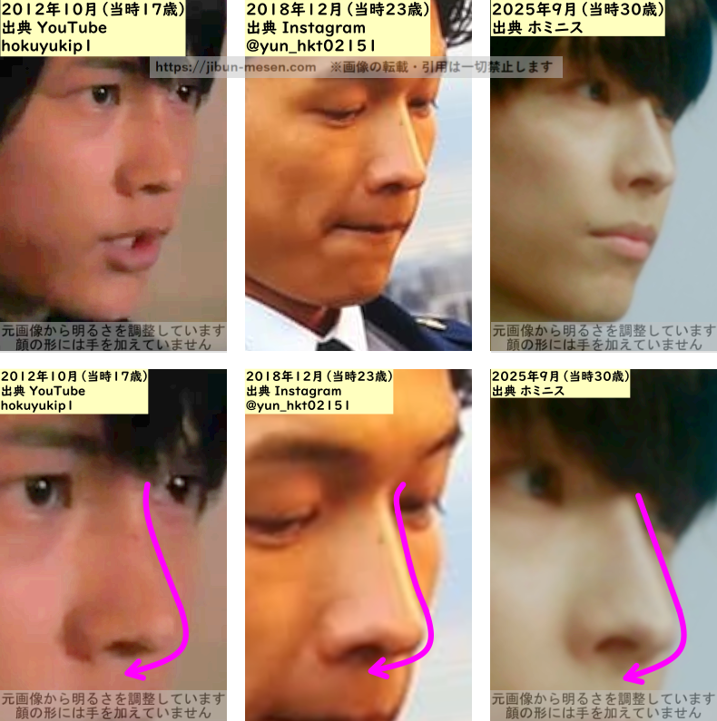 松村北斗の鼻の整形検証2012年~2025年(横顔)の画像