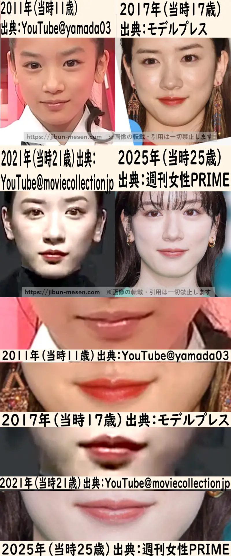 永野芽郁の唇と輪郭の整形検証2011年~2026年の画像