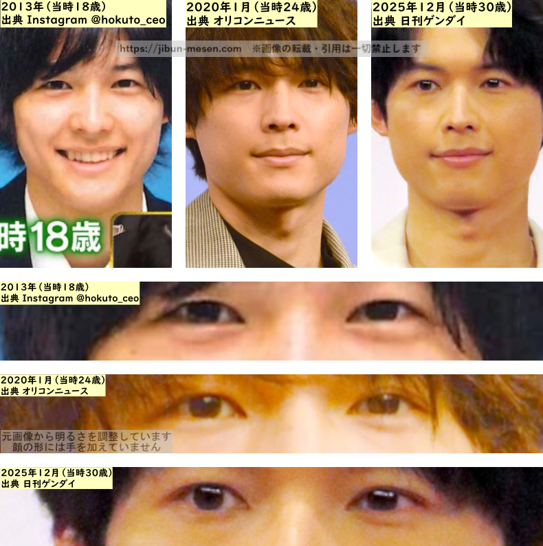 松村北斗の目の整形検証2013年~2025年の画像